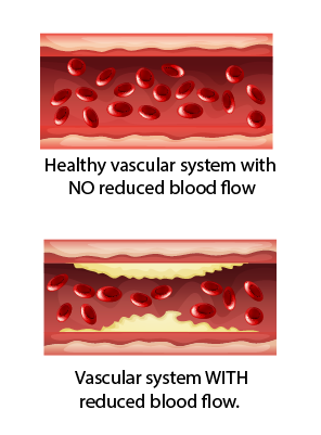 Vascular example